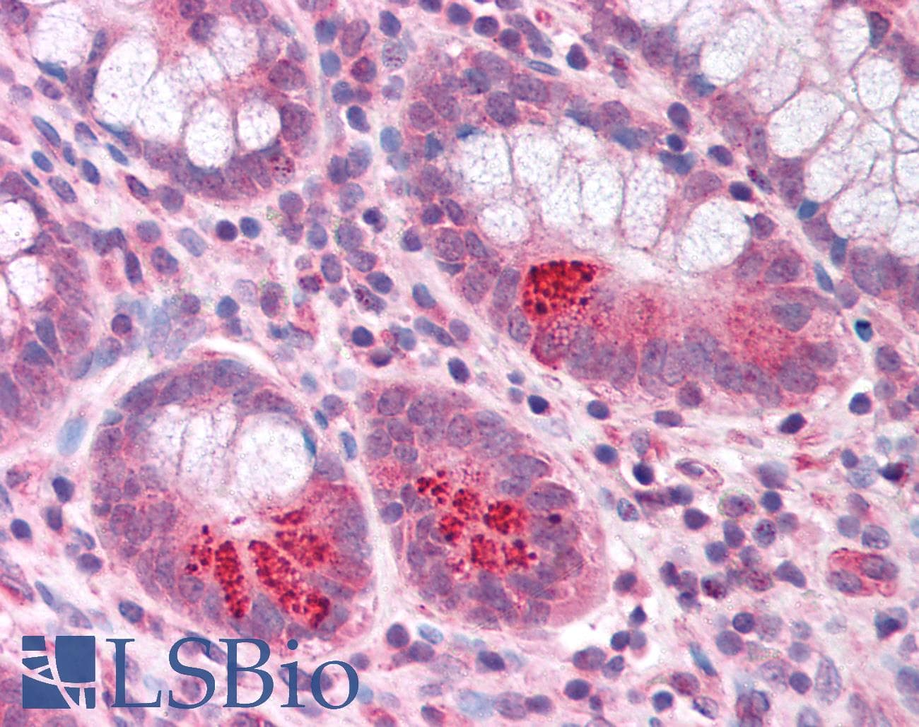 IHC-plus™ MMP17 Antibody (aa409-423)