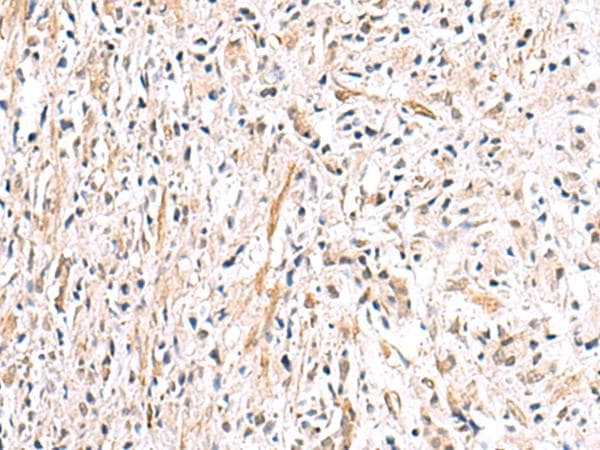 Polyclonal Rabbit anti-Human HLA-DOB Antibody (IHC, WB)