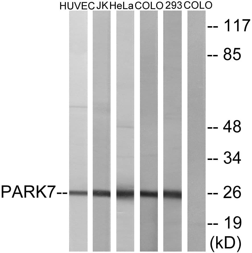 Polyclonal Rabbit anti-Human PARK7 / DJ-1 Antibody (aa61-110, WB)