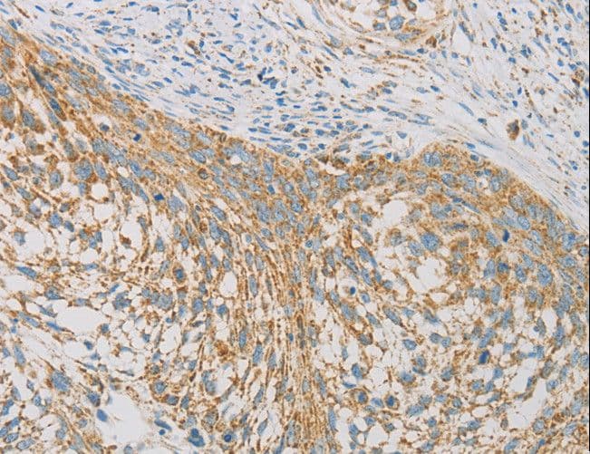 REN / Renin 1 Antibody