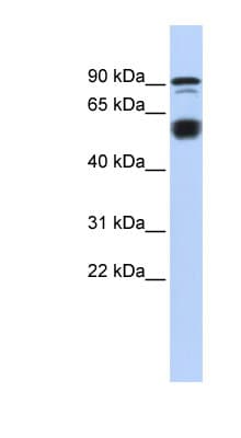 Polyclonal Rabbit anti-Human BCL11A Antibody (N-Terminus, IHC, WB)
