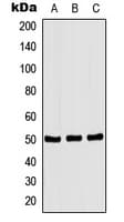 c-Src Kinase / CSK Antibody (phospho-Ser364)
