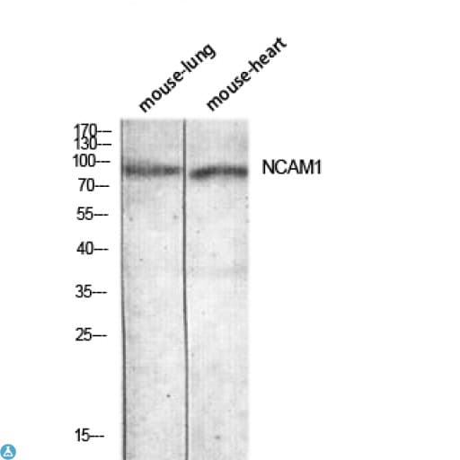 NCAM / CD56 Antibody