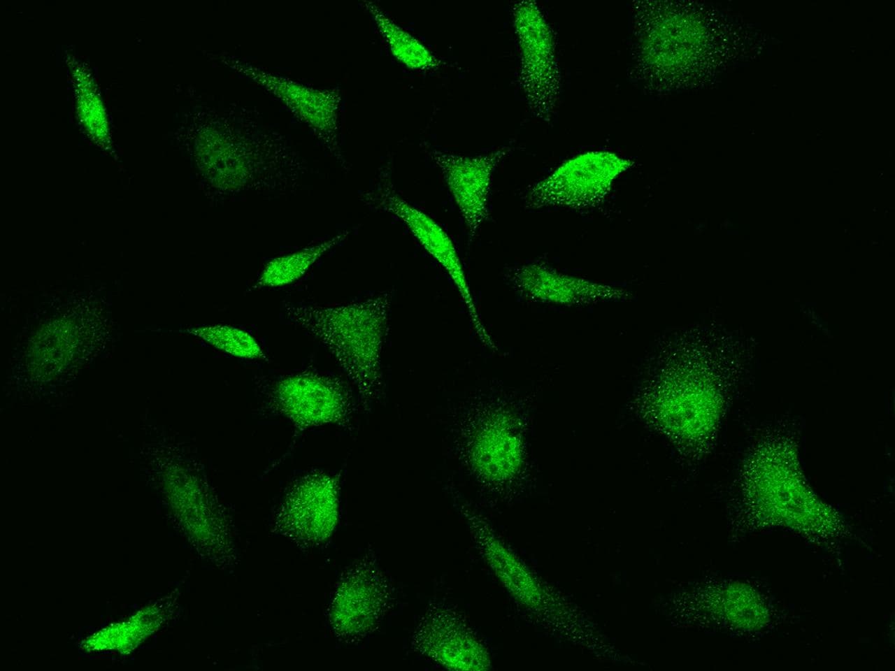 TNNC1 / Cardiac Troponin C Antibody (Preservative Free)