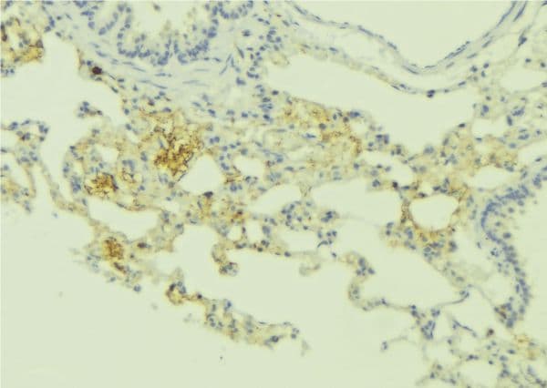 Polyclonal Rabbit anti-Human RRAD Antibody (IHC, IF, WB)