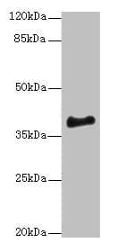 Polyclonal Rabbit anti-Human ERLIN1 / SPFH1 Antibody (IHC, WB)