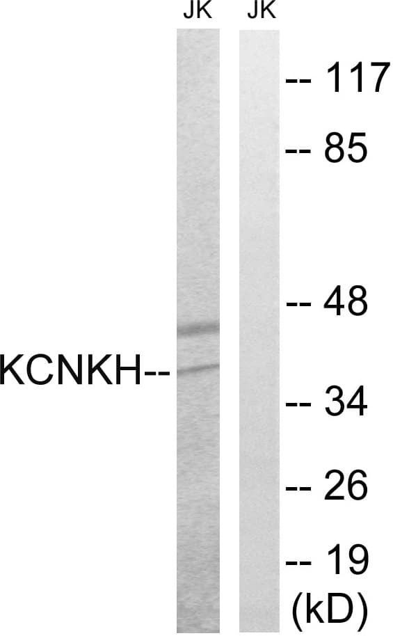 KCNK17 Antibody (aa271-320)