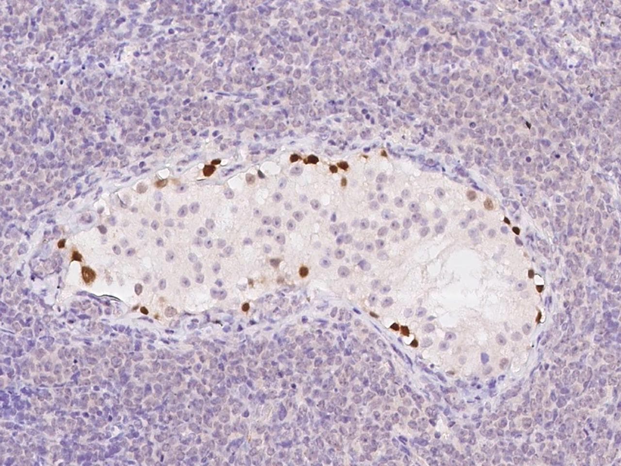 Polyclonal Rabbit anti-Human HIWI2 / PIWIL4 Antibody (IHC)