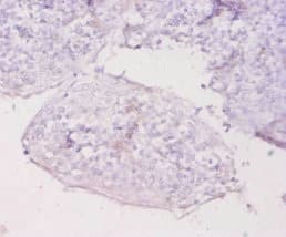 Polyclonal Rabbit anti-Human MT1E Antibody (WB)