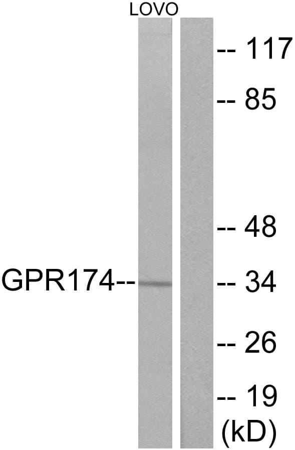 GPR174 Antibody (aa126-175)