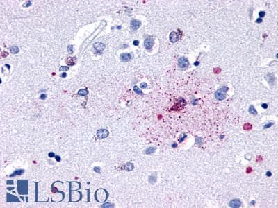 PathPlus™ GPR139 Antibody (Cytoplasmic Domain)