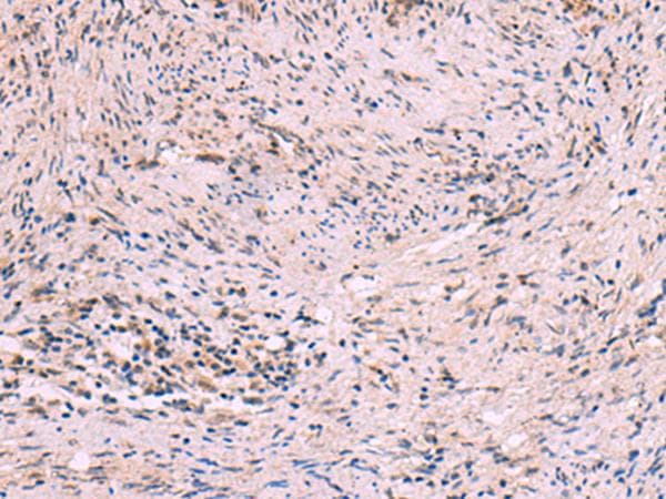 Polyclonal Rabbit anti-Human MBTPS2 Antibody (IHC, WB)
