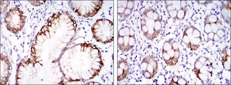 CA9 / Carbonic Anhydrase IX Antibody (clone 2D3)