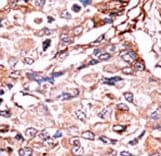 SMAD3 Antibody (phospho-Ser213)
