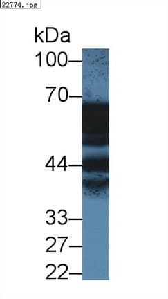 ANXA11 / Annexin XI Antibody (aa1-505)