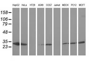 AK3 / Adenylate Kinase 3 Antibody (clone OTI6B7, Carrier-free)