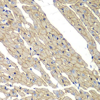 SGCD / Delta-Sarcoglycan Antibody