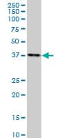 DMC1 Antibody (clone 4A10)