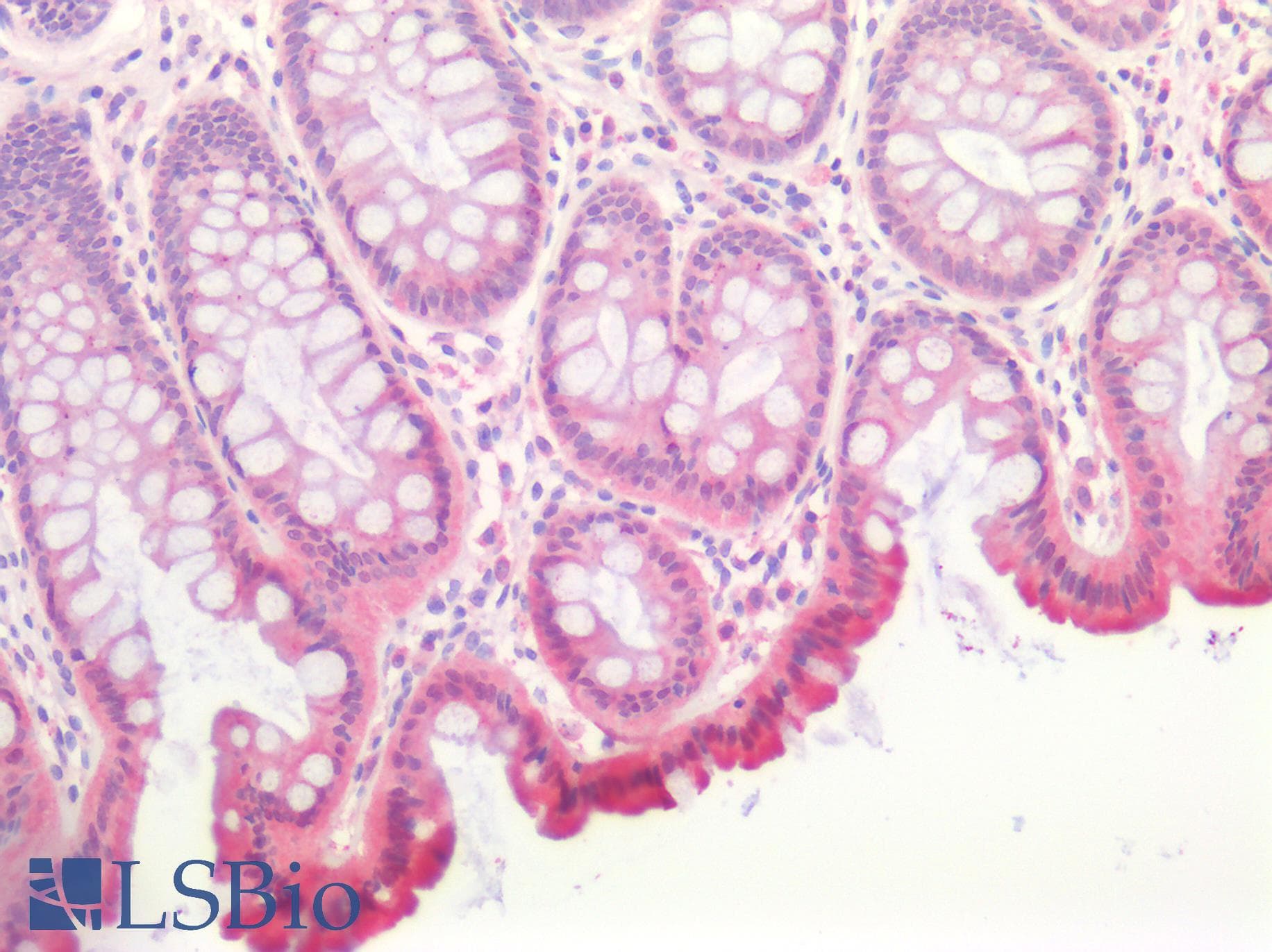 IHC-plus™ ERBB3 / HER3 Antibody (aa20-285)
