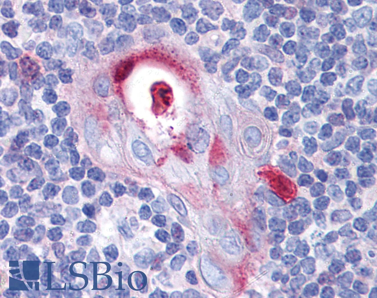 IHC-plus™ Polyclonal Rabbit anti-Human SPI1 / PU.1 Antibody (IHC, WB)