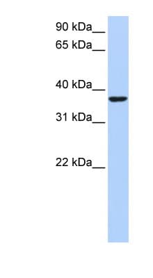 HMG20B / BRAF35 Antibody (aa201-250)