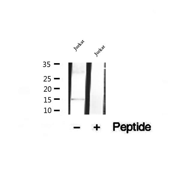 EAT2 / SH2D1B Antibody