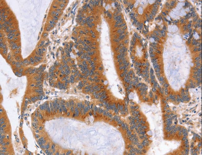 NOD1 Antibody