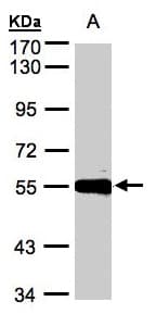 Polyclonal Rabbit anti-Human CPM / Carboxypeptidase M Antibody (aa43-303, WB)