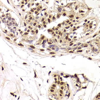 Polyclonal Rabbit anti-Human SNRPA / U1A Antibody (IHC, IF, WB)