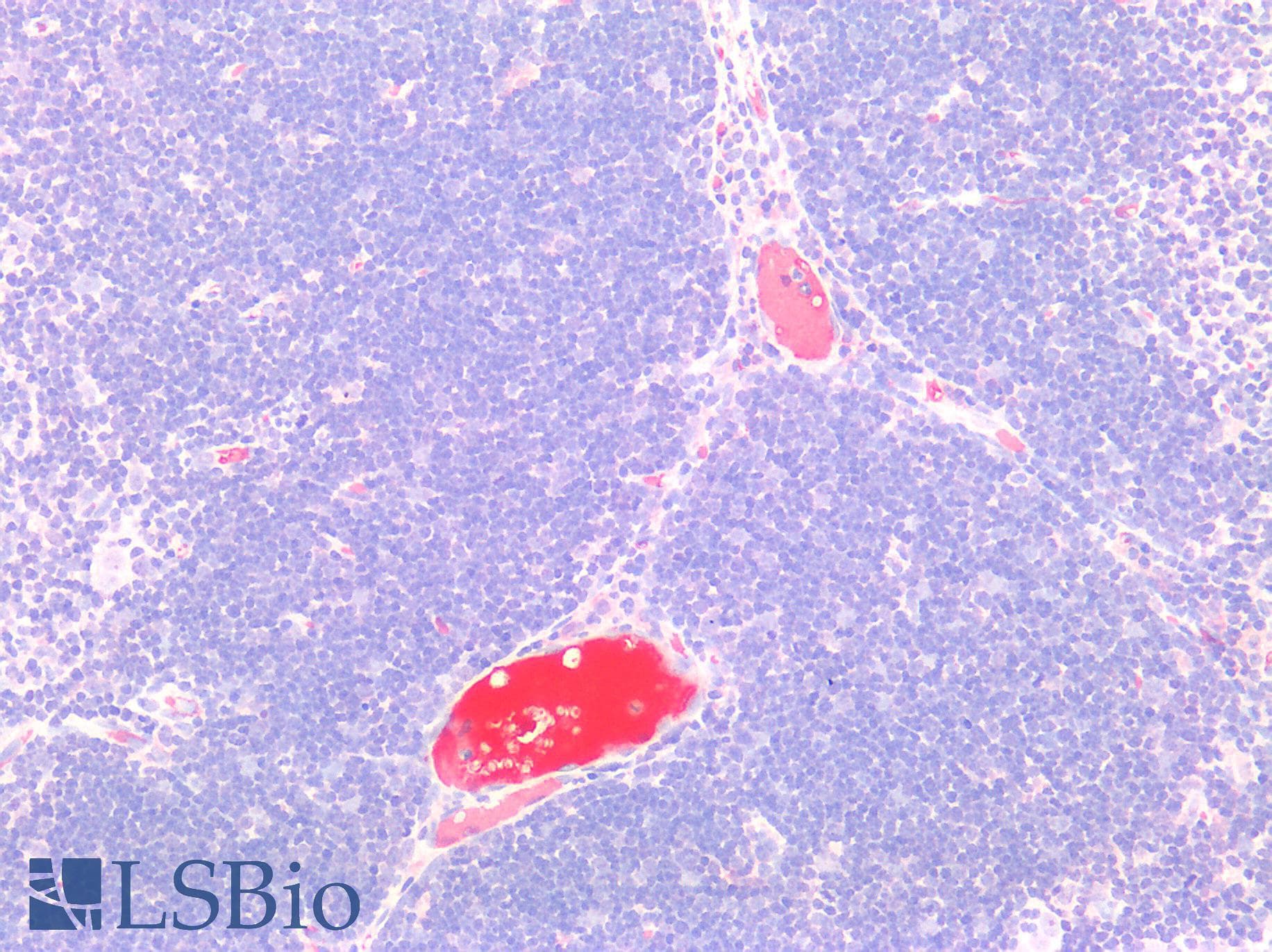 IHC-plus™ Complement C9 Antibody (clone C9-5-48)