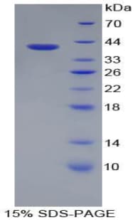 Rat Apolipoprotein A-II (Recombinant His-GST)