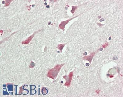 IHC-plus™ RCBTB1 Antibody (Internal)