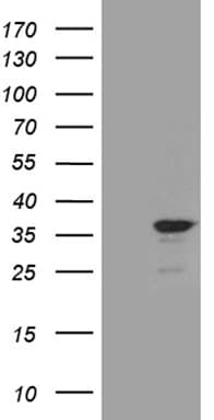 C14orf80 Antibody (clone OTI1H5)