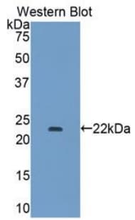 COL15A1 / Collagen XV Alpha 1 Antibody (aa1212-1388)