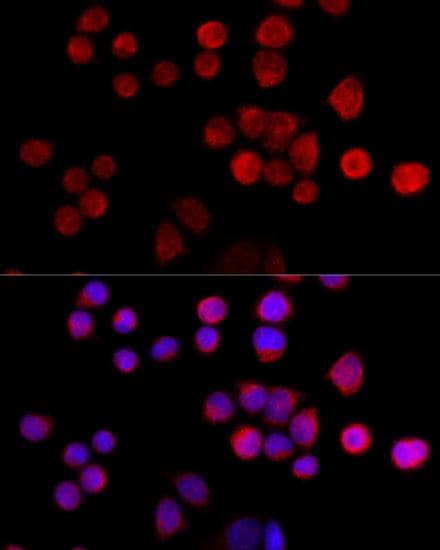 SLC25A17 Antibody
