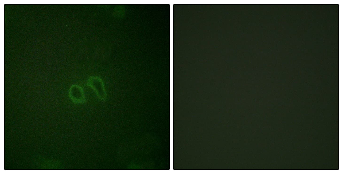VCL / Vinculin Antibody (phospho-Tyr821)