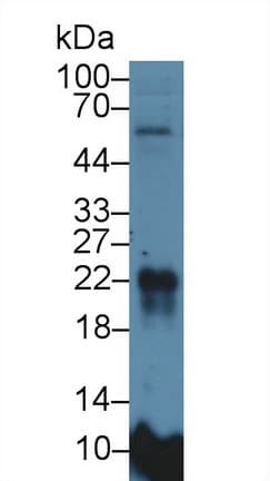 MFAP5 / MAGP2 Antibody (aa32-164)