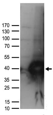 UNG / Uracil DNA Glycosylase Antibody