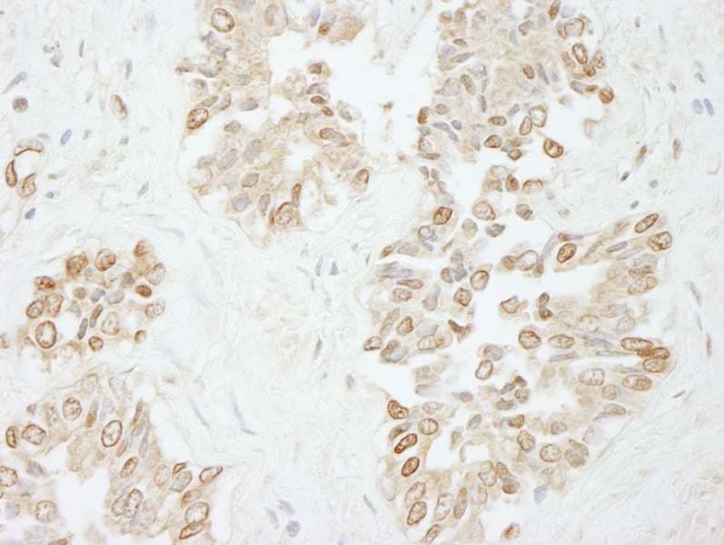 POLL / DNA Polymerase Lambda Antibody (aa525-575)