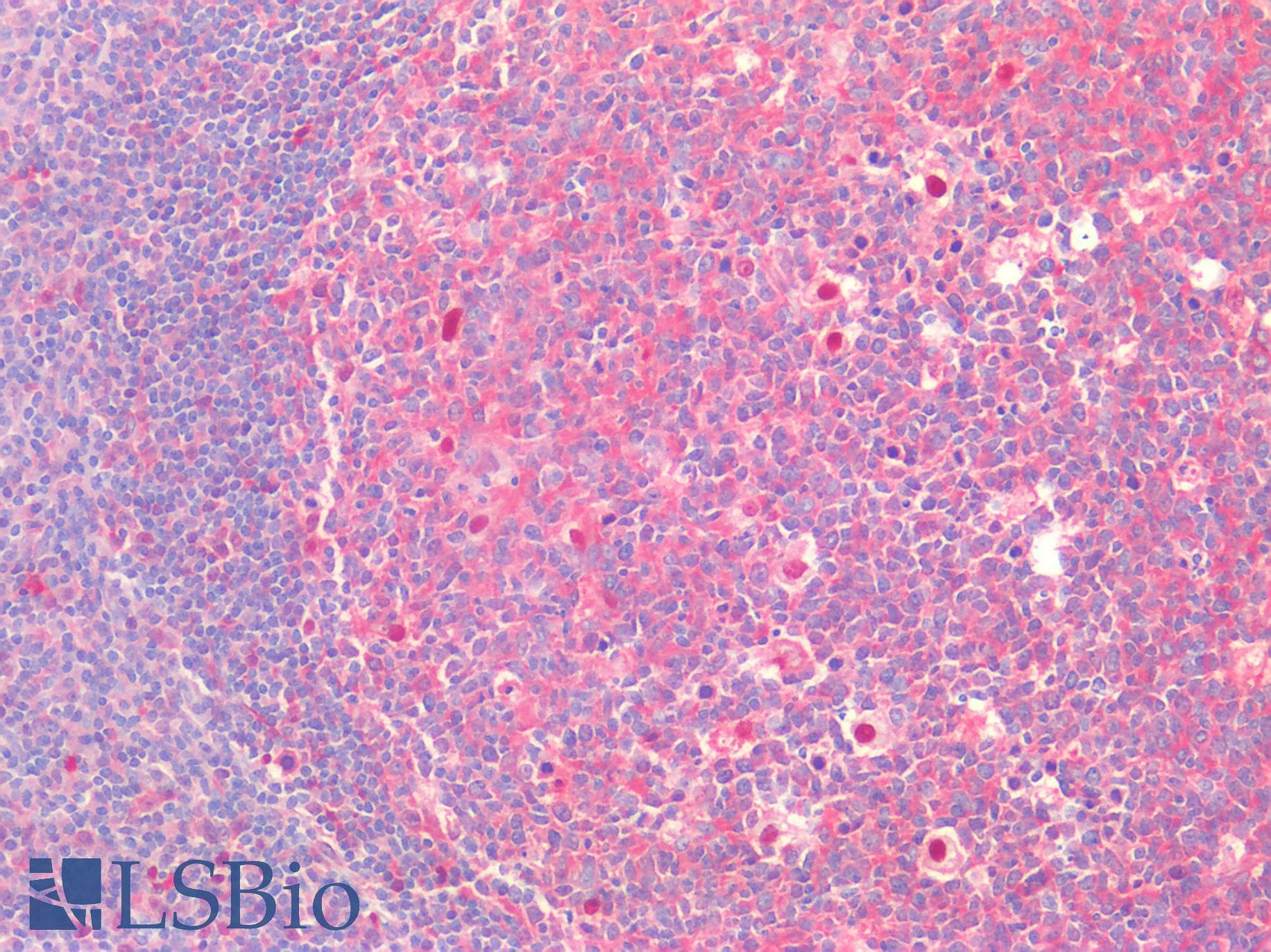IHC-plus™ CD81 Antibody
