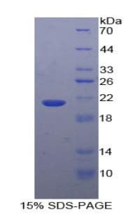 Human GAA / Alpha-Glucosidase, Acid Protein (Recombinant His)