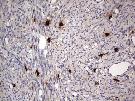 Monoclonal Mouse anti-Human SMPD1 / Acid Sphingomyelinase Antibody (clone OTI3H7, aa62-341, IHC, WB)