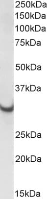 IHC-plus™ ATP5C1 Antibody (aa272-286)