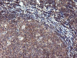 TULP3 Antibody (clone OTI7B8)