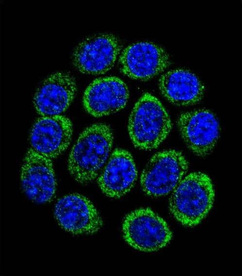 TPH1 / Tryptophan Hydroxylase Antibody (aa35-62)