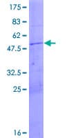 Human MRPL24 Protein (Recombinant GST)
