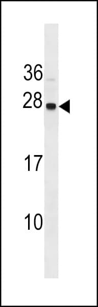 SYNGR1 / Synaptogyrin 1 Antibody (aa154-183)