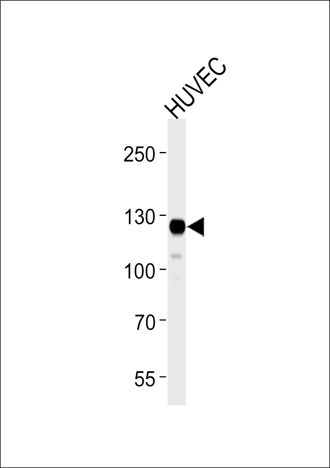 Monoclonal Mouse anti-Human FAK / Focal Adhesion Kinase Antibody (clone 1297CT261.163.145, aa1-128, WB)