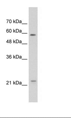 Polyclonal Rabbit anti-Human CAV1 / Caveolin 1 Antibody (N-Terminus, IHC, WB)