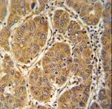 Polyclonal Rabbit anti-Human GLOD2 / MCEE Antibody (aa128-156, IHC, WB)